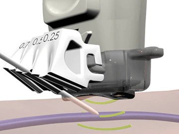 catheter-guidance-systems_R_201776606.jpg